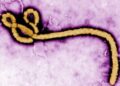 FG Confirms Ebola Case in Abuja, Tracks 44 Contacts