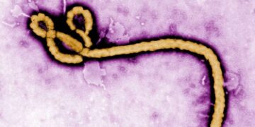 FG Confirms Ebola Case in Abuja, Tracks 44 Contacts